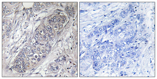 Anti-EIF4EBP1 antibody (13-62 aa) (STJ91383) – Figure 1 of 1