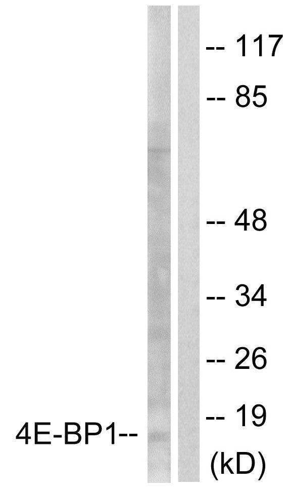 Anti-EIF4EBP1 antibody (30-79 aa) (STJ91384) – Figure 1 of 1