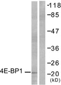 Anti-EIF4EBP1 antibody (4-53 aa) (STJ91386) – Figure 1 of 1