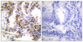 Anti-EIF4EBP1 antibody (2-51 aa) (STJ91387) – Figure 1 of 1