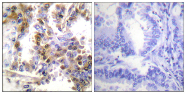 Anti-EIF4EBP1 antibody (2-51 aa) (STJ91387) – Figure 1 of 1