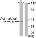 Anti-ACTA1 antibody (1-50 aa) (STJ91462) - Figure 1 of 4