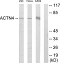 Anti-Actinin-Alpha 1/2/3/4 antibody (21-70 aa) (STJ91466) - Figure 1 of 4