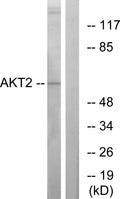 Anti-AKT2 antibody (432-481 aa) (STJ91552) – Figure 1 of 1