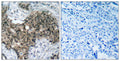 Anti-ATM antibody (1950-1999 aa) (STJ91762) – Figure 1 of 1