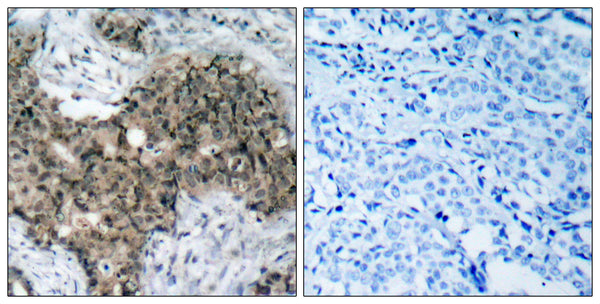 Anti-ATM antibody (1950-1999 aa) (STJ91762) – Figure 1 of 1