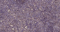 Anti-ATM antibody (1920-2000 aa) (STJ91763) – Figure 1 of 1