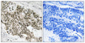 Anti-ATR antibody (394-443 aa) (STJ91781) – Figure 1 of 1