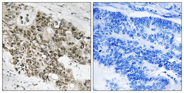Anti-ATR antibody (394-443 aa) (STJ91781) – Figure 1 of 1