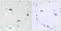 Anti-BAD antibody (61-110 aa) (STJ91797) – Figure 1 of 1