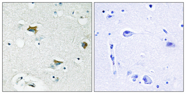 Anti-BAD antibody (61-110 aa) (STJ91797) – Figure 1 of 1