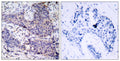 Anti-BAD antibody (102-151 aa) (STJ91798) – Figure 1 of 1