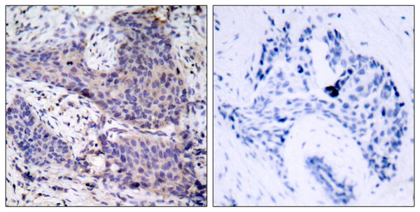 Anti-BAD antibody (102-151 aa) (STJ91798) – Figure 1 of 1