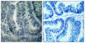 Anti-BAD antibody (78-127 aa) (STJ91799) – Figure 1 of 1
