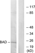 Anti-BAD antibody (119-168 aa) (STJ91801) – Figure 1 of 1