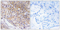 Anti-TRAPPC1 antibody (10-59 aa) (STJ91852) – Figure 1 of 1