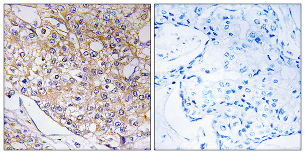 Anti-TRAPPC1 antibody (10-59 aa) (STJ91852) – Figure 1 of 1