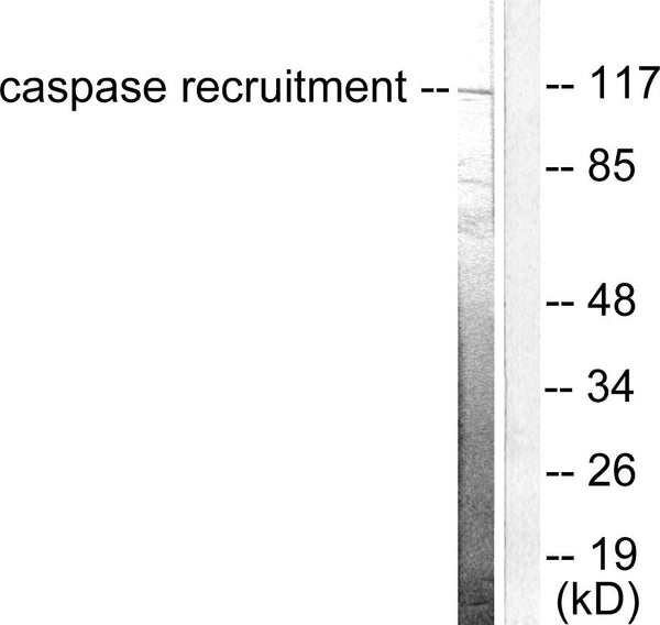 Anti-CARD6 antibody (1-50 aa) (STJ92002) – Figure 1 of 1