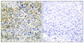 Anti-SHPK antibody (31-80 aa) (STJ92004) – Figure 1 of 1