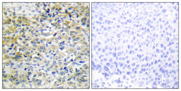 Anti-SHPK antibody (31-80 aa) (STJ92004) – Figure 1 of 1