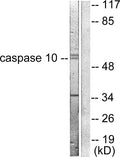 Anti-Caspase-10 B/C antibody (430-479 aa) (STJ92018) - Figure 1 of 4