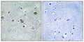 Anti-CDC42EP5 antibody (1-50 aa) (STJ92176) – Figure 1 of 1