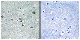 Anti-CDC42EP5 antibody (1-50 aa) (STJ92176) – Figure 1 of 1