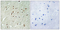 Anti-CNTROB antibody (591-640 aa) (STJ92220) – Figure 1 of 1