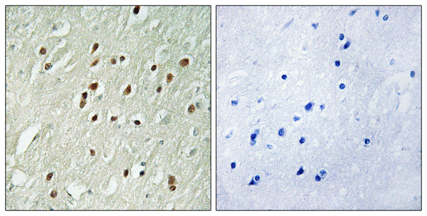 Anti-CNTROB antibody (591-640 aa) (STJ92220) – Figure 1 of 1