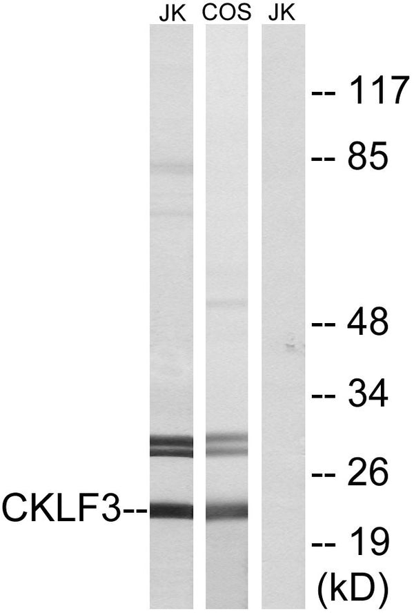 Anti-CMTM3 antibody (1-50 aa) (STJ92350) – Figure 1 of 1