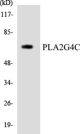 Anti-PLA2G4C antibody (301-350 aa) (STJ92450) – Figure 1 of 1