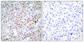 Anti-CREB1 antibody (100-149 aa) (STJ92462) – Figure 1 of 1