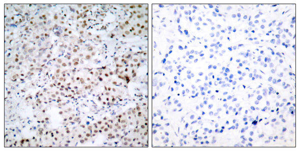 Anti-CREB1 antibody (100-149 aa) (STJ92462) – Figure 1 of 1