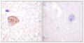 Anti-DDX3X antibody (466-515 aa) (STJ92676) – Figure 1 of 1