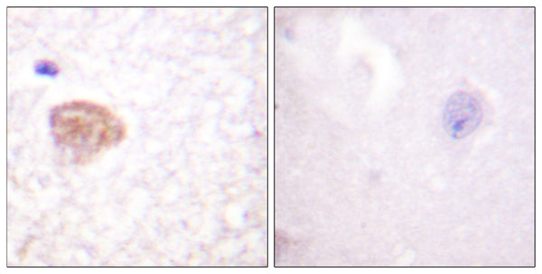 Anti-DDX3X antibody (466-515 aa) (STJ92676) – Figure 1 of 1