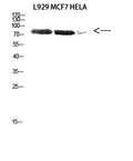 Anti-DDX3 antibody (14-63 aa) (STJ92677) – Figure 1 of 1