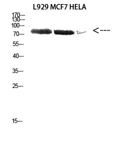Anti-DDX3 antibody (14-63 aa) (STJ92677) – Figure 1 of 1