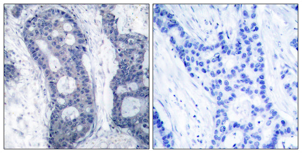 Anti-EIF4E antibody (168-217 aa) (STJ92881) – Figure 1 of 1