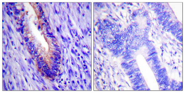 Anti-EIF4G1 antibody (1074-1123 aa) (STJ92883) – Figure 1 of 1