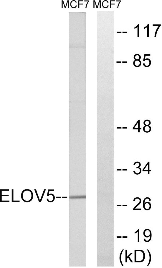Anti-ELOVL5 antibody (250-299 aa) (STJ92904) – Figure 1 of 1