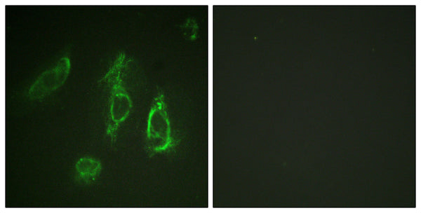 Anti-EPOR antibody (341-390 aa) (STJ92962) – Figure 1 of 1