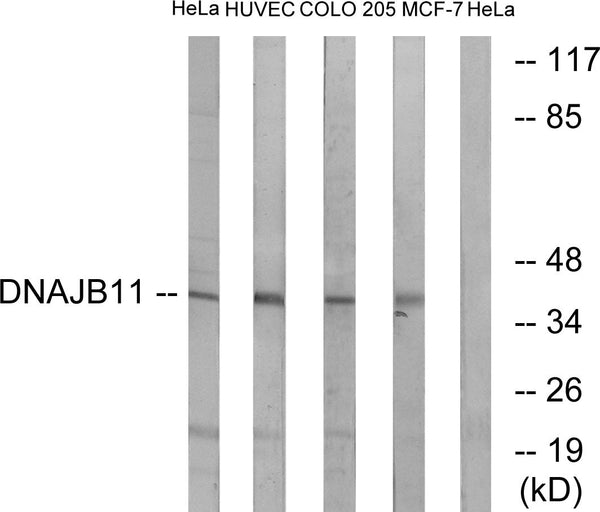 Anti-DNAJB11 antibody (31-80 aa) (STJ92981) – Figure 1 of 1