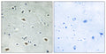 Anti-CBFA2T3 antibody (261-310 aa) (STJ93008) – Figure 1 of 1