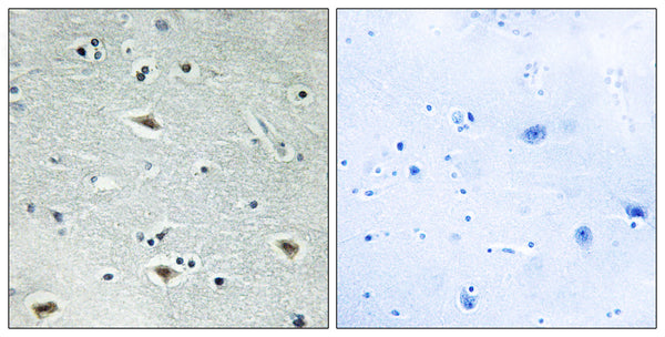 Anti-CBFA2T3 antibody (261-310 aa) (STJ93008) – Figure 1 of 1