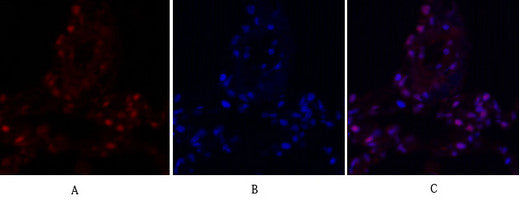 Anti-PTK2 antibody (809-858 aa) (STJ93024) – Figure 1 of 1