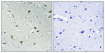 Anti-FAM111B antibody (281-330 aa) (STJ93034) – Figure 1 of 1