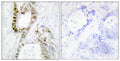 Anti-FANCA antibody (1121-1170 aa) (STJ93039) – Figure 1 of 1