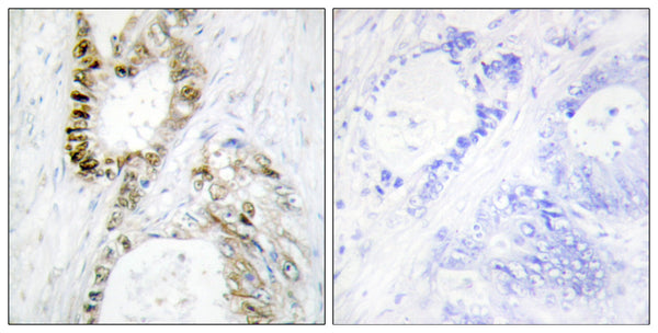 Anti-FANCA antibody (1121-1170 aa) (STJ93039) – Figure 1 of 1