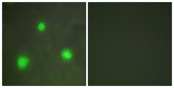 Anti-FOXH1 antibody (10-59 aa) (STJ93044) – Figure 1 of 1