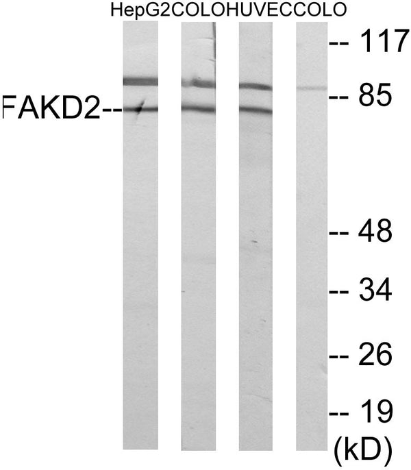 Anti-FASTKD2 antibody (171-220 aa) (STJ93046) – Figure 1 of 1
